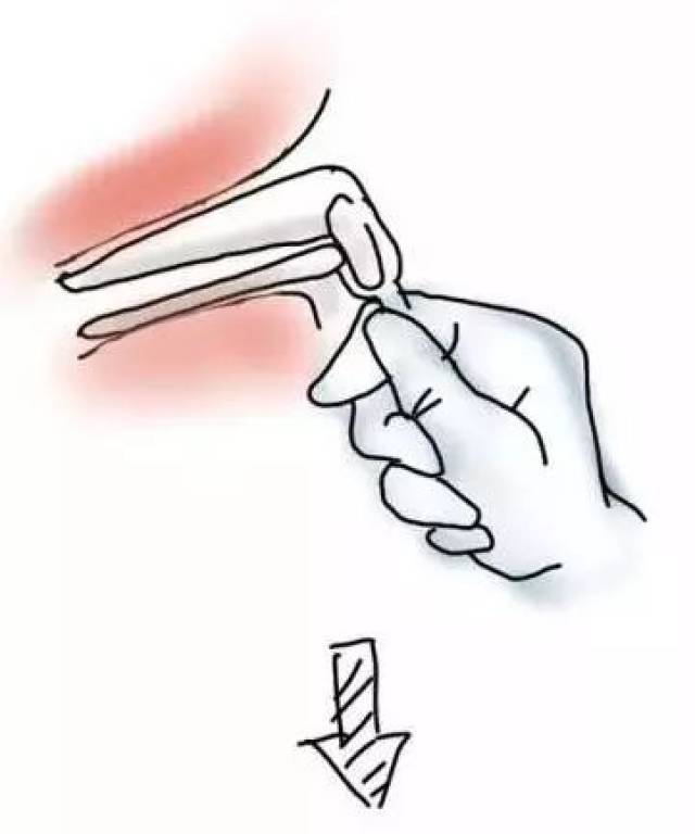 妇科检查流程