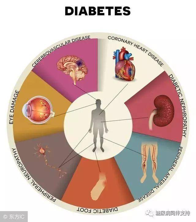 一,糖尿病并发症分急,慢性并发症