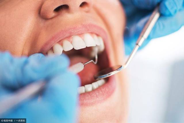 2,拔牙前应彻底清洁口内的牙石,假牙保证口腔卫生,以防术后感染,肿胀