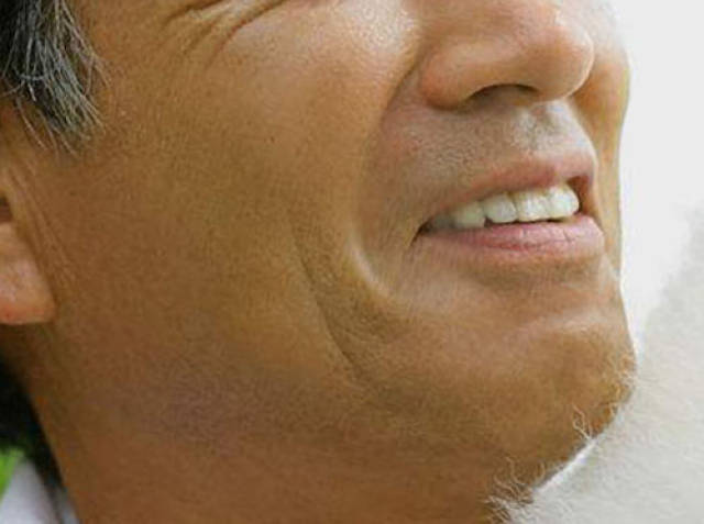 在我们的生活中,有时见到一些人经常出现面部肌肉抖动的情况,尤其是