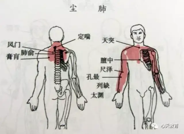 中医艾灸治疗哮喘!