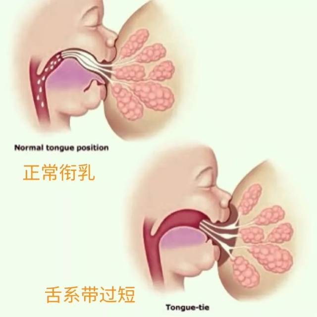 宝宝舌头出现这个形状,你一定要重视