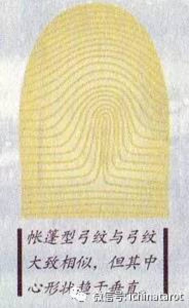 帐篷型弓纹
