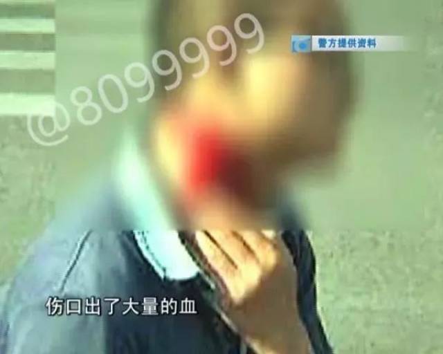 云南男子因倒烂菜叶被行拘,罚20万;玉溪一学生因一根烟持刀捅伤4名