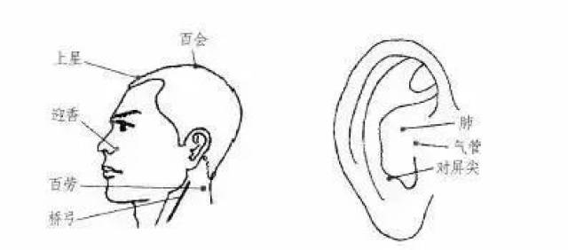 头部按摩:迎香,百会,上星,桥弓,百劳等穴,及肺,气管,对屏尖等耳穴.