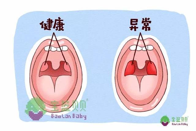 张口呼吸时,舌头后坠下沉以打开口腔通道,长此以往,原本应该往前往下