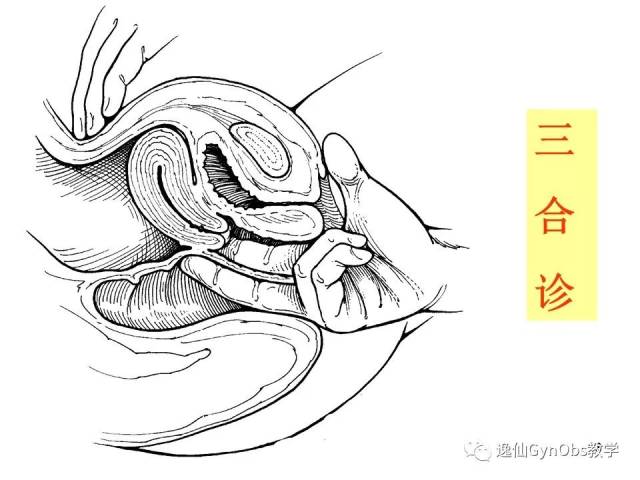 聚焦中山女性健康：优质妇科诊疗环境与服务