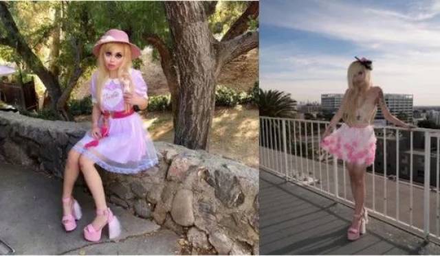 中外混血女孩整容成芭比，竟因看不起自己的亚洲脸