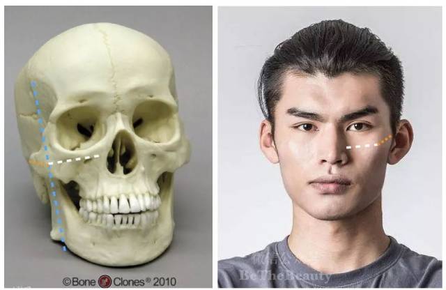 亚洲人头骨和亚洲人脸型