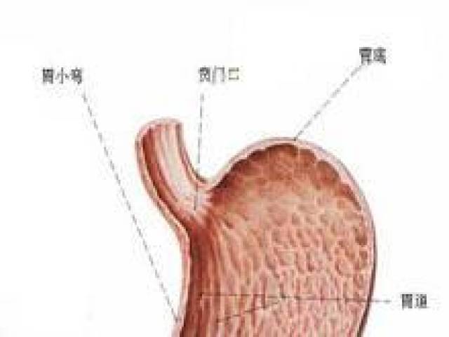 贲门炎跟环境,饮食,体质等与幽门螺杆菌感染,胃食管反流病有关