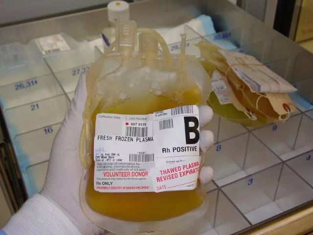 被捐赠的血浆通常被称作"生命的礼物",虽然很多美国人只是为了换钱.