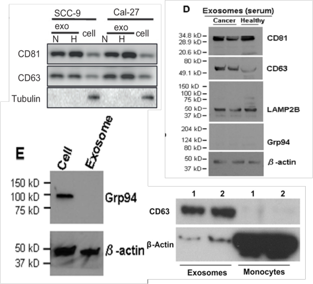 做外泌体 western blot 鉴定吗?先来这看看!