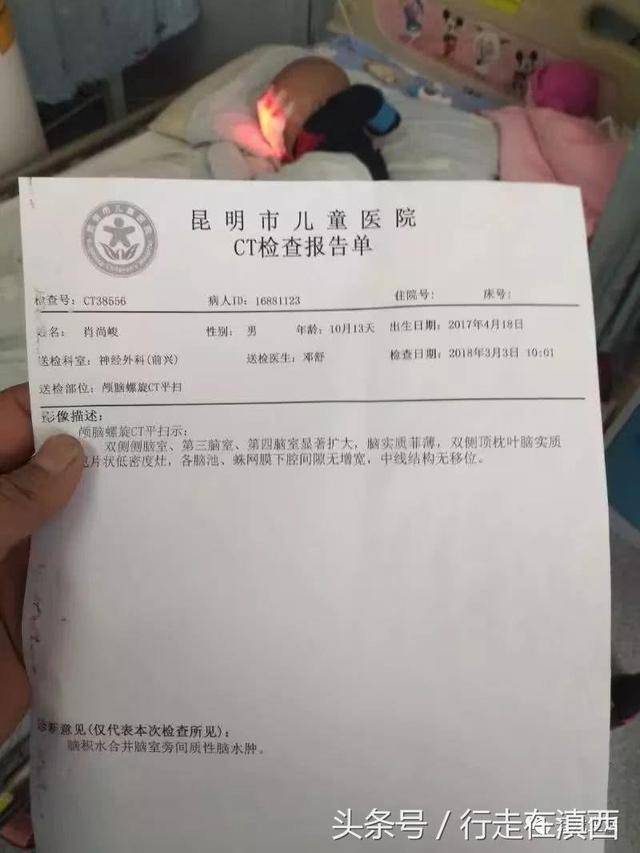 上图为昆明市儿童医院ct检查报告单,诊断意见:脑积水合并脑室旁间质