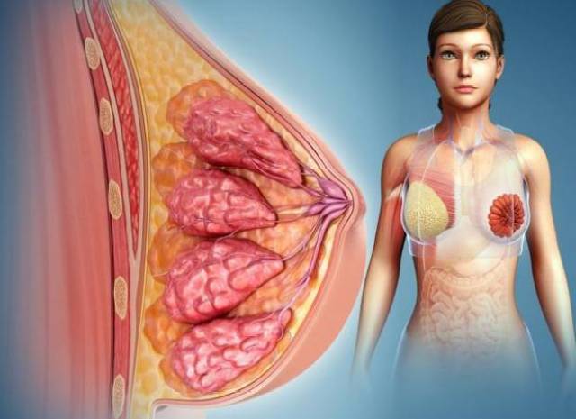 乳腺结核可并有皮肤溃疡或瘘管,乳腺癌可出现皮肤内陷形成"酒窝征"