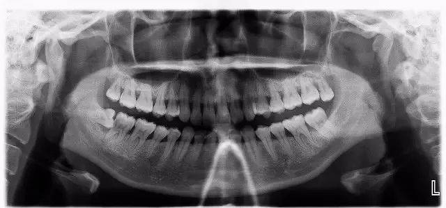 可以从多角度看出颌骨牙齿的内部结构,还有各个组织之间的关系,很真实