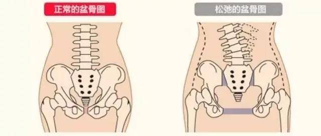 答:生完宝宝胯骨变宽是所有妈妈都会出现的问题,而胯骨变宽的罪魁