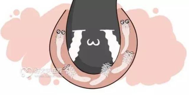 鼻子属于脸部的危险三角区,如果消毒做得不到位,细菌从鼻子周围的