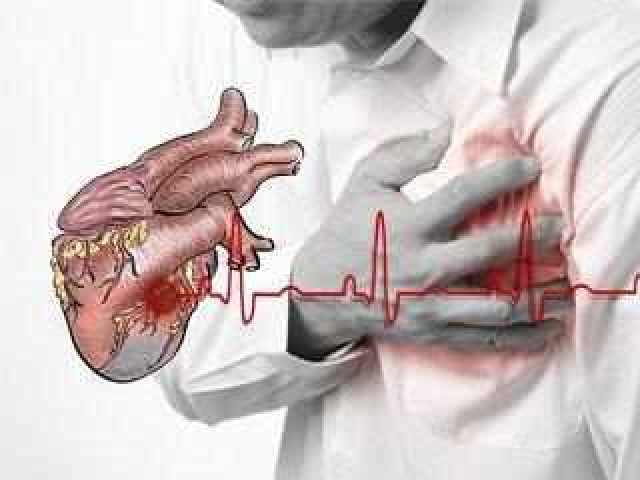 心绞痛的特点为阵发性前胸压榨样疼痛感,主要位于胸骨后部,其主要的