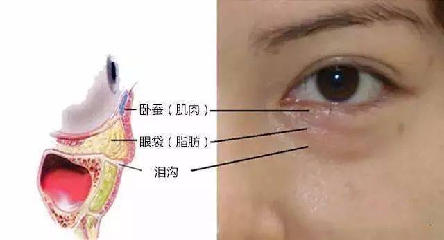 虽然眼袋和卧蚕的位置都在眼睛下方,但给面相带来的影响还是有很大