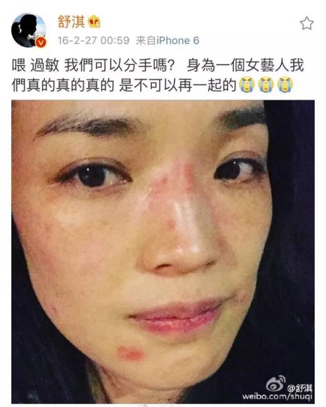 舒淇这样不缺护肤品的女明星,原来也会烂脸?