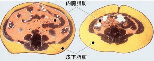 肥胖,让肚子变大的罪魁祸首?怎么减大肚子