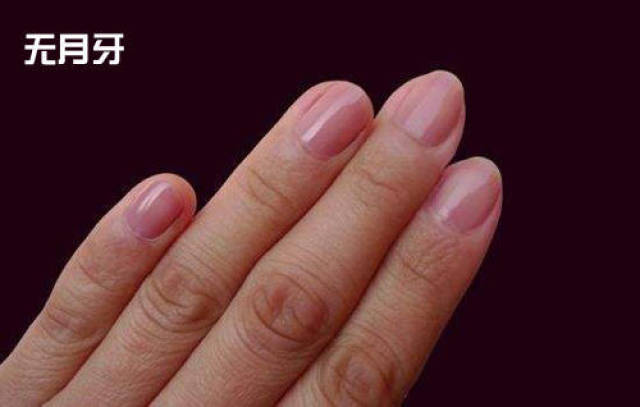 科学解释从指甲上看健康!指甲上有这种纹的要注意啦!