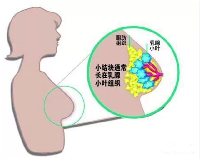 人口增生_疤痕增生图片(2)