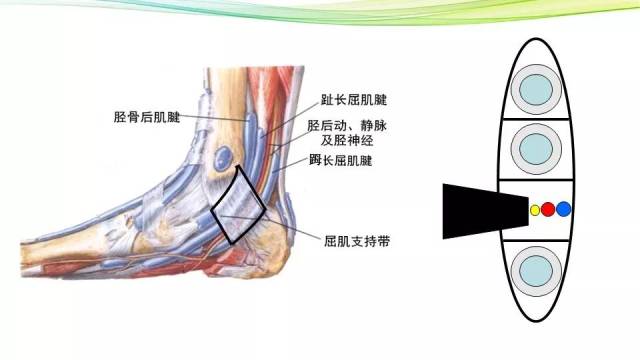 小小讲堂——踝管综合征的诊断与治疗(一)