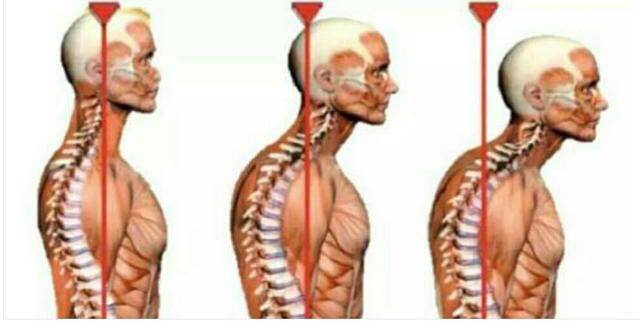 1 自我评测颈部大包方法:双脚与肩同宽,把脚,臀和肩胛骨都靠在墙上