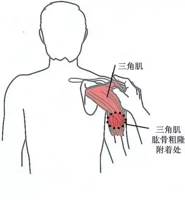 抵止于肱骨三角肌粗隆.