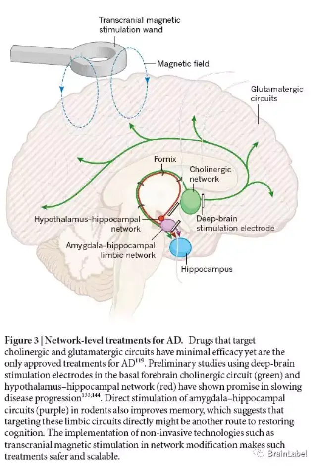 经典nature综述翻译 针对阿尔茨海默病的神经环路恢复疗法路线(2016年