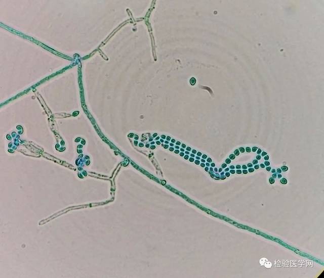 可形成长链,无厚壁孢子.