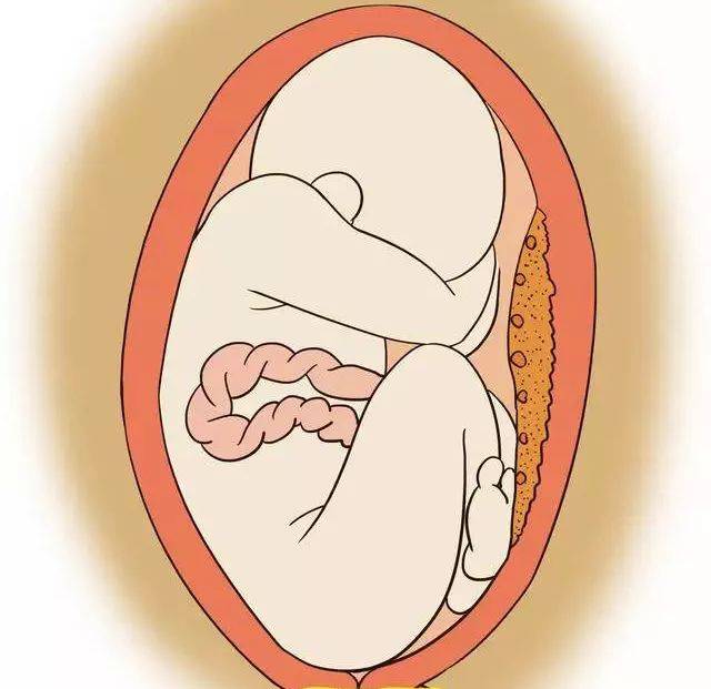 我们接着往下看↓ 宝宝腿不直,大多正常 孩子刚出生的时候,由于在