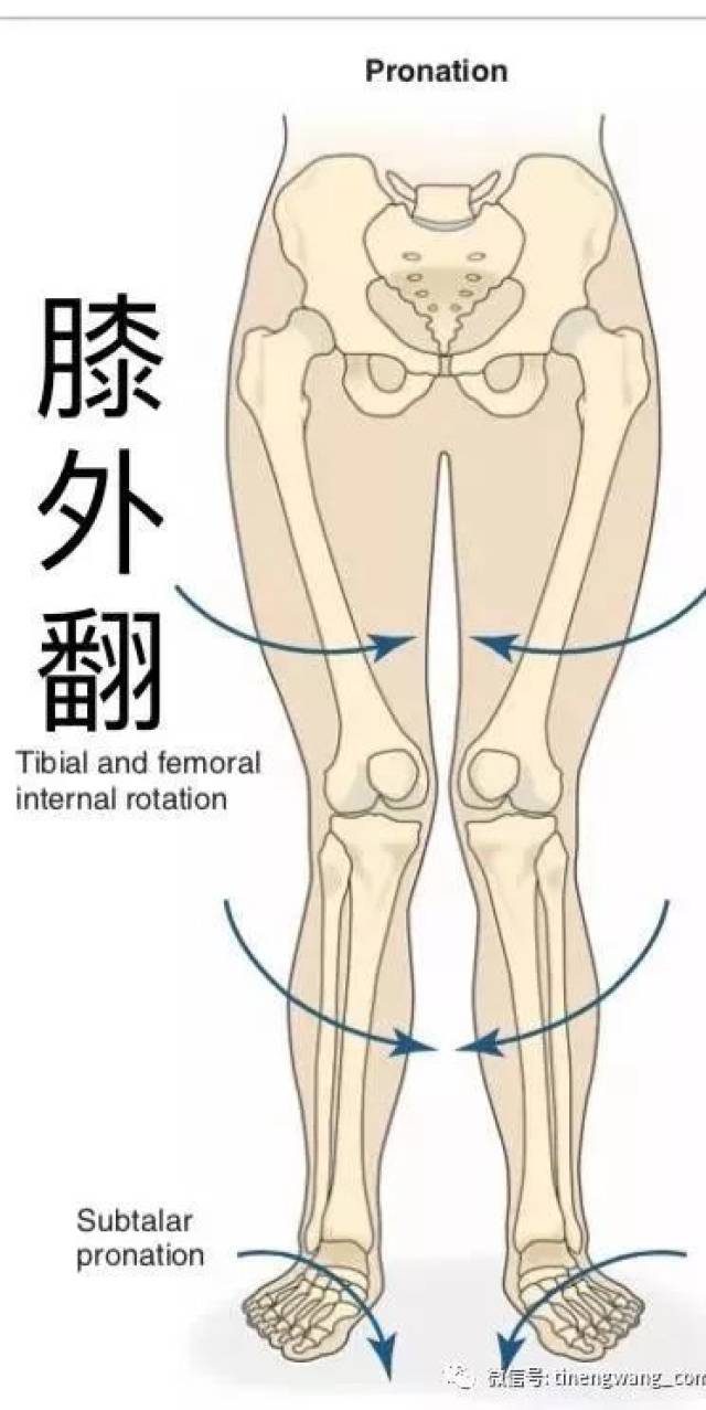 以下图常见的膝外翻为例[5],即膝盖内扣,足踝外翻,足弓塌陷.