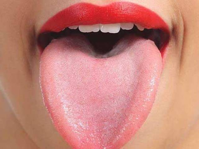 正常的舌头,舌体胖瘦适中,转动灵活;舌质淡红,润泽;舌苔薄白,颗粒均匀