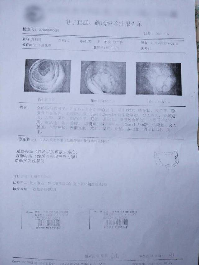 胃镜活检报告_宫颈活检报告图样_穿刺活检报
