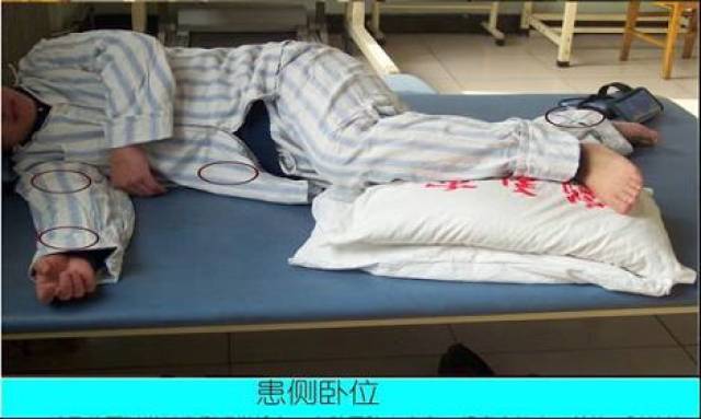 家庭康复护理的方法 1 肢体运动功能锻炼 ①良肢位的摆放:平卧位,患