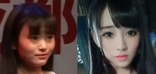 四千年美女鞠婧祎整容曝光 表情失控惊现蜂窝下巴