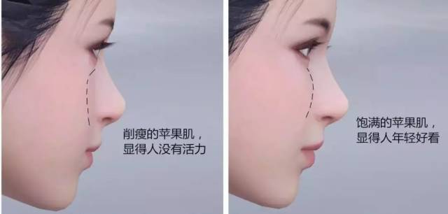 不管是否整容,早期的天使宝贝也太好看了,苹果肌饱满圆润的为她的少女