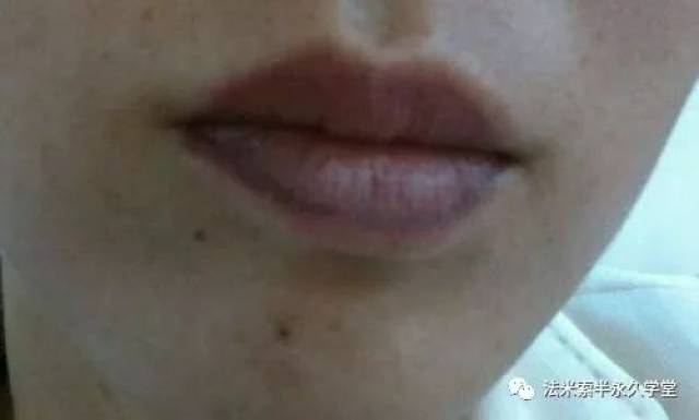 色素沉着的原因和解决方法 c64eed395296495b900139001a4c3f52.jpeg