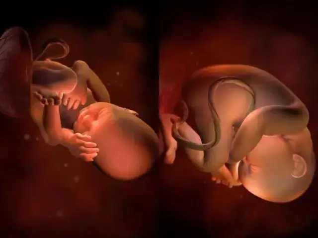 孕32周胎儿继续长大,皮下脂肪会更丰富,胎儿的皮肤皱纹就会越来越少