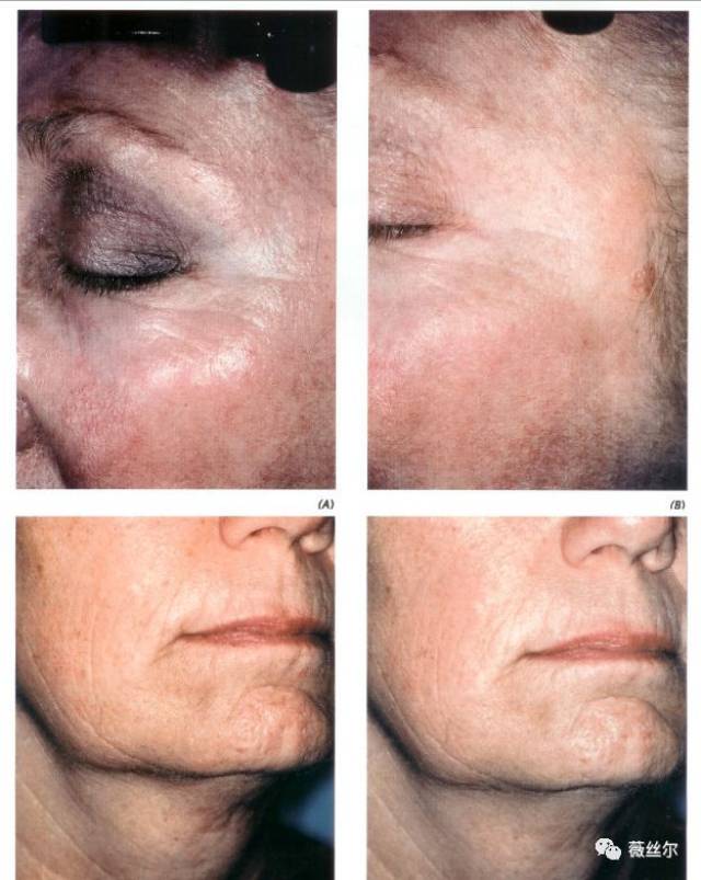 别被这些所谓的“干细胞美容”忽悠