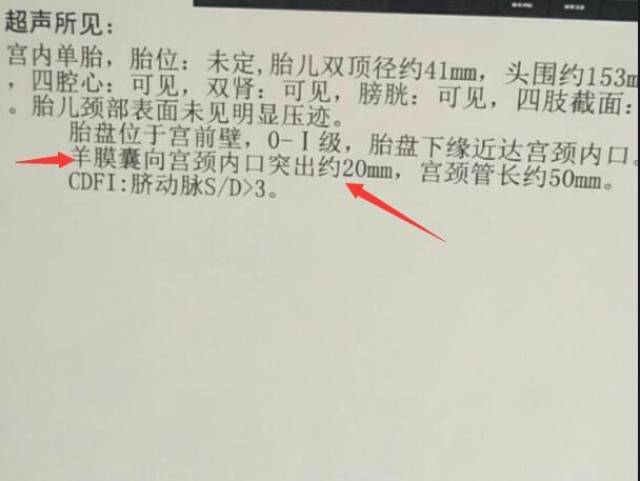 惊心48小时:县医院妇产科检出羊膜囊突出,省妇幼的结果完全不同