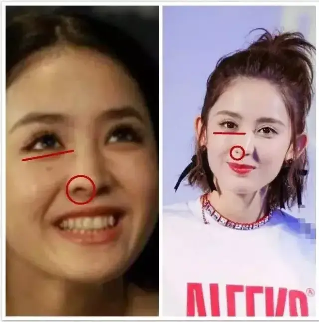 娜扎的鼻孔从不对称无法呼吸变正常精致,是又做修复手术了?