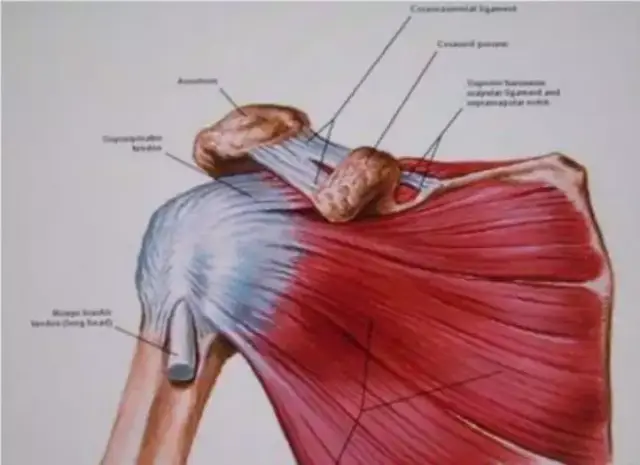 右肩袖撕裂!罗湖医院集团骨伤科妙手回春