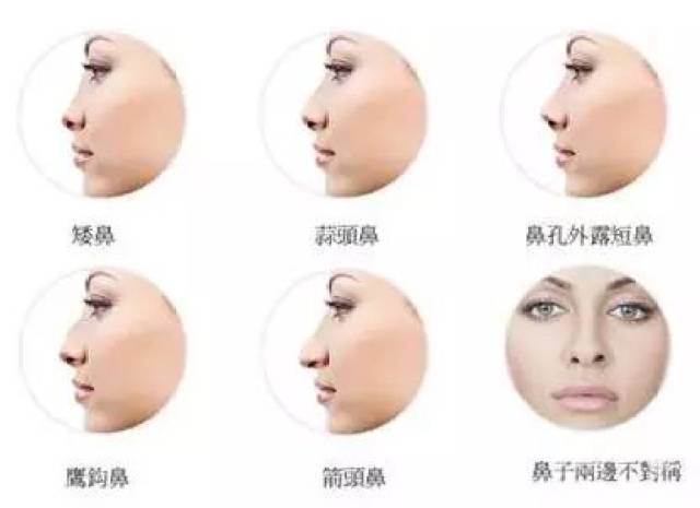 中国女性中 鼻子短小 大众称之为蒜头鼻 的人特别多 从地域上来看