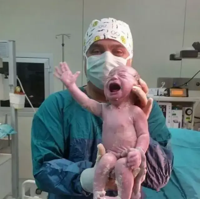 这宝宝太任性!出生后伸手抓住医生的剪刀,不让医生剪脐带!