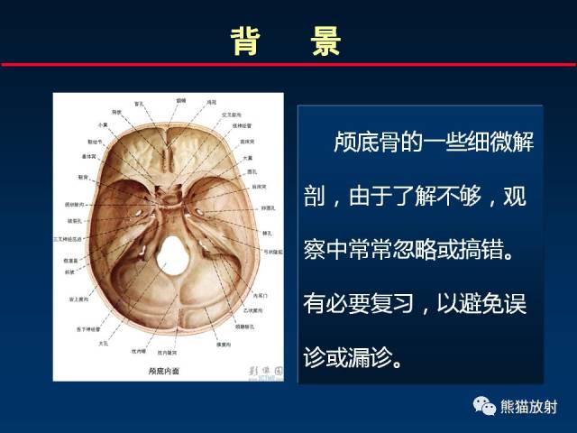 颅底重要ct解剖及其临床意义