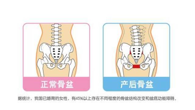 可以去产后修复中心进行修复,因为整个孕产过程中,骨骼的变化肯定不一