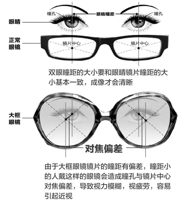 相比正常大小的镜框,大框眼镜的光学中心点和瞳孔的偏移位置会更大